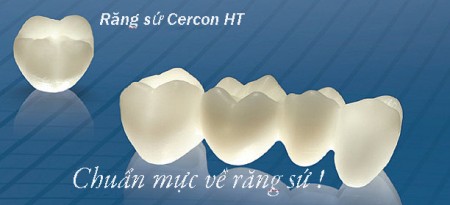 Những điều cần biết về răng sứ Cercon