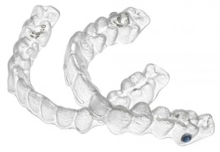 Niềng răng không nhổ răng với khay niềng invisalign 