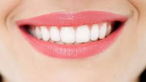 Niềng răng một hàm có hiệu quả không? 