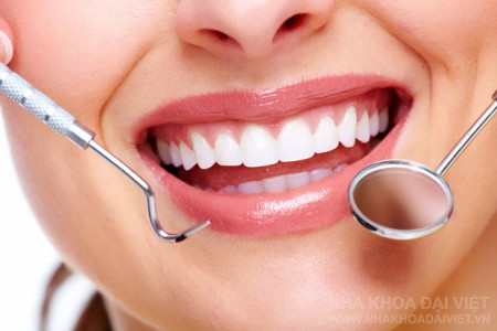 Niềng răng mặt trong giá có đắt không? 2 Niềng răng mặt trong giá có đắt không? 2