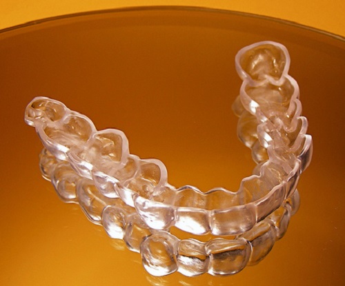Tại sao nên chọn invisalign để chỉnh nha? 1