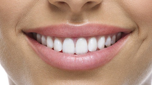 Các loại răng sứ phổ biến-2