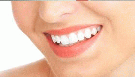 Chăm sóc răng sứ như thế nào là đúng cách