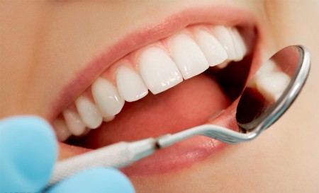 Quy trình chữa răng sâu