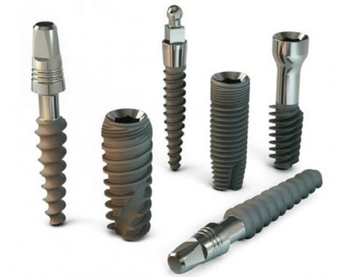 Giảm chi phí cấy ghép implant