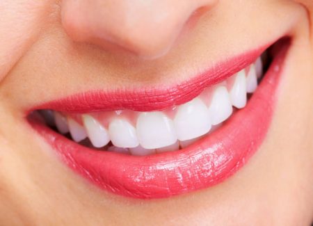 Cạo vôi răng có ảnh hưởng gì không? 3