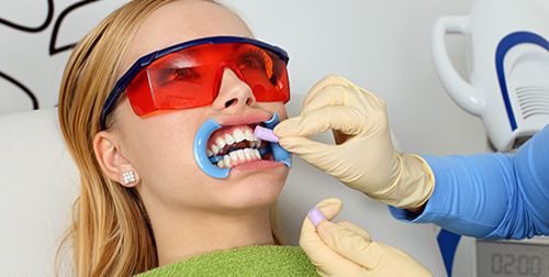 Một số lưu ý khi tẩy trắng răng bị nhiễm Tetracycline 3