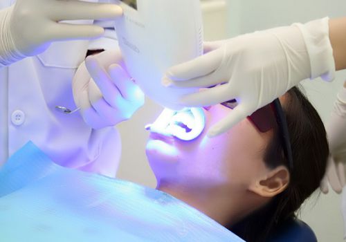 Tẩy trắng răng có nguy hiểm không? - Xin lời khuyên 1