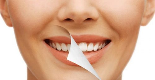 5 lý do bạn nên tìm hiểu sau tẩy trắng răng kiêng ăn gì 1 5 lý do bạn nên tìm hiểu sau tẩy trắng răng kiêng ăn gì 1