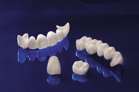 Răng sứ cercon-1 Răng sứ cercon-1