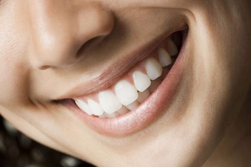 Răng sứ zirconia 2