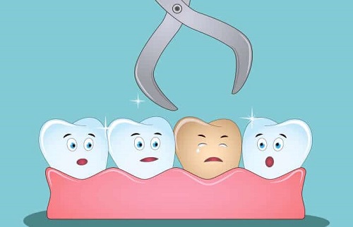 Nhổ răng hàm có nguy hiểm không?  2