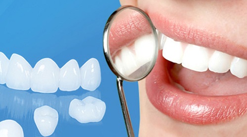 Bọc răng sứ có ảnh hưởng gì không về phương diện sức khỏe?-1