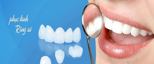 Bọc răng sứ cercon được đánh giá cao về thẩm mỹ 1
