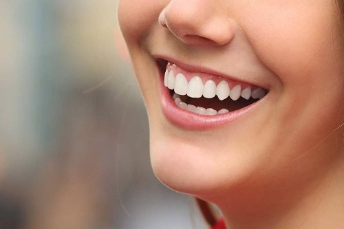 Phương pháp bọc răng sứ không cần mài răng hiệu quả nhất cho bạn-4