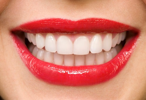 Bọc răng sứ ở đâu đẹp - Nên chọn bệnh viện nha khoa hay trung tâm-1