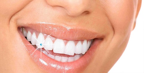 Đính đá vào răng có hại không? Lời khuyên đánh giá từ khách hàng 2