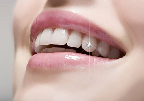 Đính đá vào răng có hại không? Lời khuyên đánh giá từ khách hàng 3