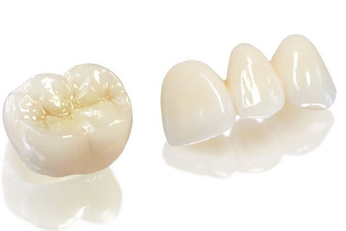 Giá bọc răng sứ zirconia tốt nhất cho bạn-2