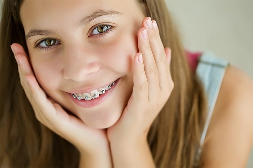 Niềng răng có hại gì không? Mặt tích cực của dịch vụ niềng răng-2