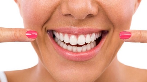 Niềng răng móm cho hàm răng đều đặn chuẩn khớp cắn 1