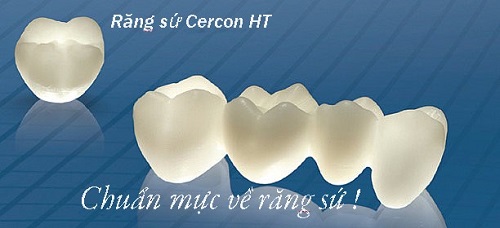 Bọc răng sứ cercon có tốt không? Có đảm bảo ăn nhai tốt? 1