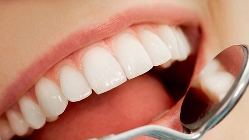Bọc răng sứ có được vĩnh viễn không khi hoàn thiện? 2