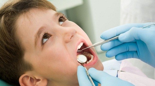 Có nên bọc răng sứ cho trẻ em? Vì sao? 3