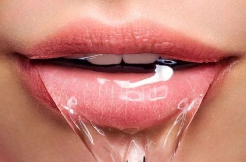 Niềng răng mặt trong giá rẻ có nên thực hiện không? 3