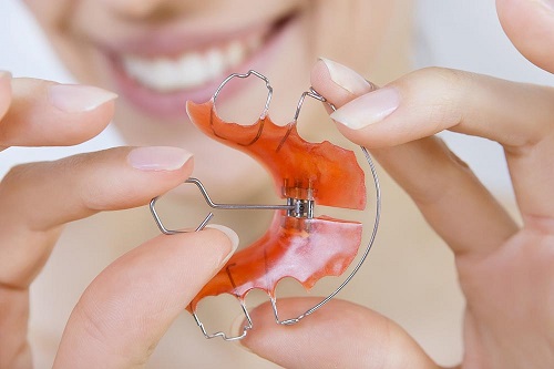 Niềng răng phải đeo hàm duy trì bao lâu vậy bác sĩ?-1