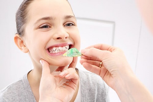 Niềng răng cho trẻ em ở đâu tphcm tốt nhất? 2