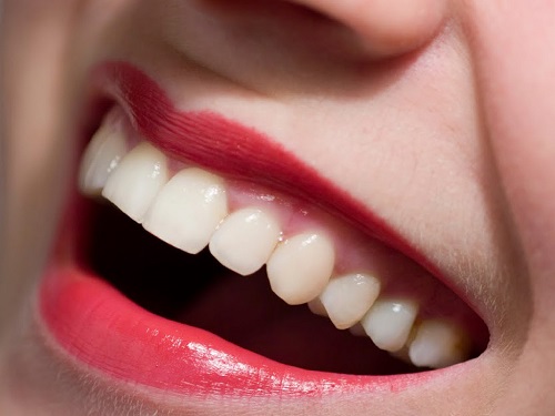 Ưu và nhược điểm của răng sứ emax cho bạn-1