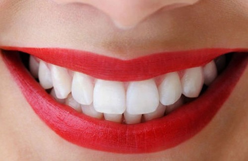 Bọc răng hàm bị sâu có đau không? Tư vấn từ nha khoa-1