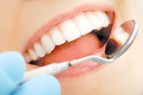 Bọc răng sứ có bị rớt ra không? Cần tìm hiểu ngay-4