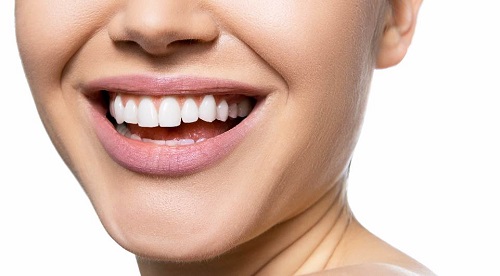 Bọc răng sứ có hết móm không khi bị móm do răng? 3