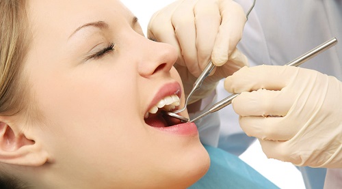 Bọc răng toàn sứ mang đến bạn nụ cười xinh tự nhiên 3