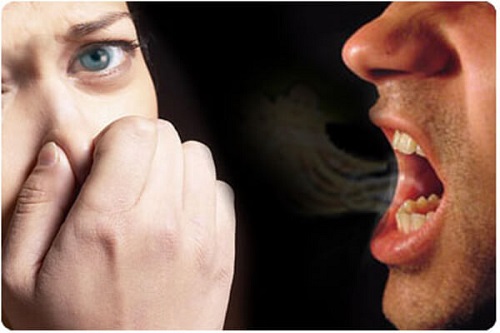 Dấu hiệu răng sứ bị hở nguyên nhân và cách khắc phục-3