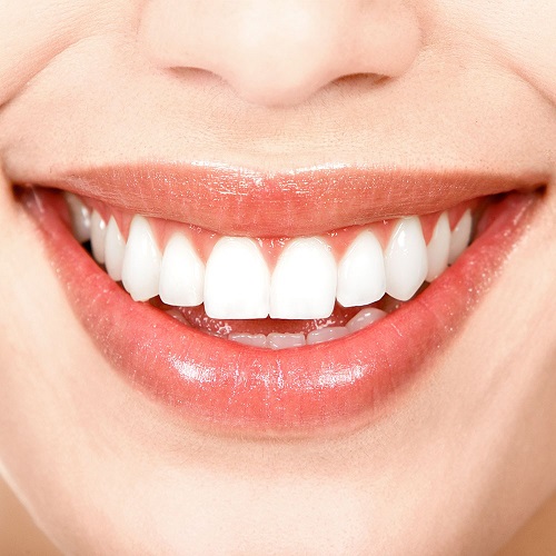 Răng sứ ceramill và những điều cần biết-3