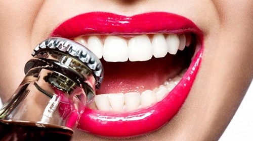 Răng sứ có bị sâu không? Cần làm gì để bảo vệ răng sứ? 3