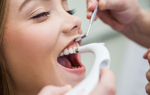 Bọc răng sứ có đính đá được không? Cần thông tin-3