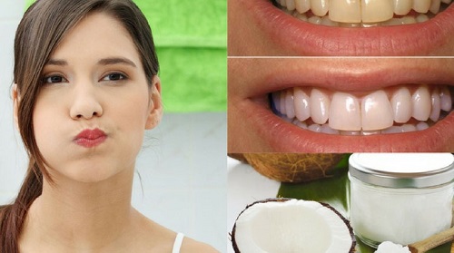 Tẩy trắng răng bằng dầu dừa có hiệu quả cao không? 3