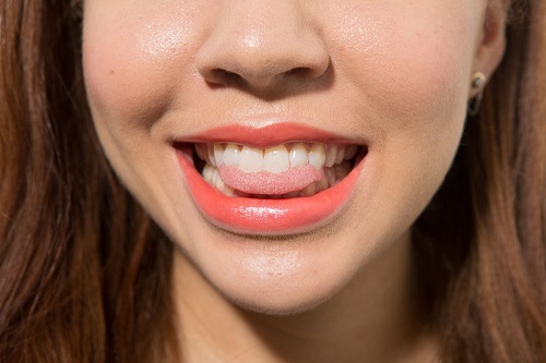 Tẩy trắng răng trong 1 tuần với phương pháp nào? 3