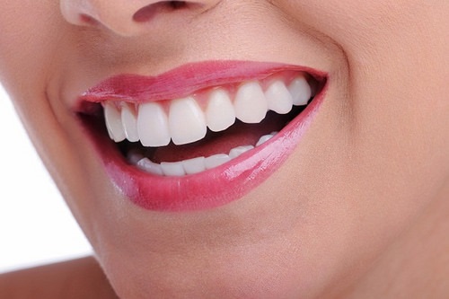 Có nên trồng răng sứ kim loại không? Lý do-4 Có nên trồng răng sứ kim loại không? Lý do-4