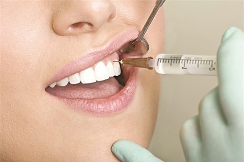 Trồng răng sứ có ảnh hưởng gì không? Chuyên gia giải đáp-3