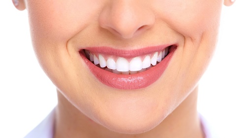 Những điều cần biết về tẩy trắng răng 3