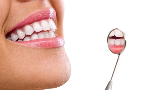 Răng sứ bị sâu có điều trị được không? Phải làm gì? 3 Răng sứ bị sâu có điều trị được không? Phải làm gì? 3