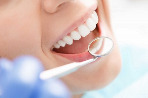 Tìm hiểu nguyên nhân gây răng sứ bị thưa và cách khắc phục 3