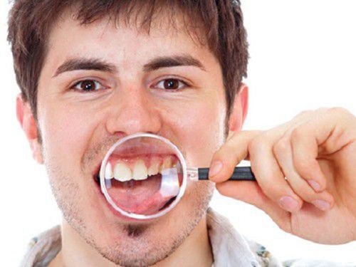 Trồng răng sứ mất thời gian bao lâu? Nên kiêng gì trước khi trồng răng-2