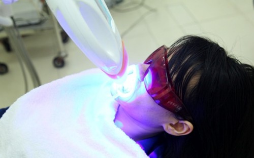 Tẩy trắng răng plasma có hại không? Tìm hiểu ngay 1