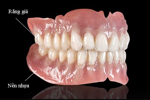 Trồng răng giả có đau không? Tìm hiểu kỹ thuật trồng-2